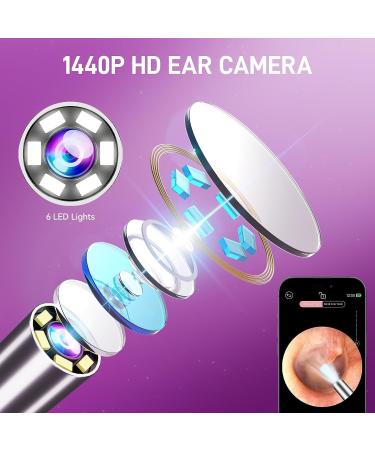 Zupora 1440P HD Ear Camera Ear Wax Removal Kit | WiFi Otoscope for Android & iOS | 6 Ear Pick Tools | Ear Cleaning Kit - Gradient Pink - Buy Online on GoSupps.com