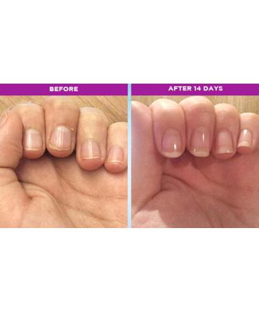 Trind Nail Repair Pink Pearl - Strengthening Nail Treatment 9ml | Best for Damaged Nails - Fast International Shipping - Buy Online on GoSupps.com