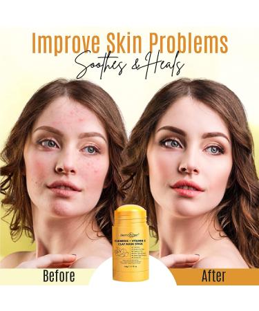 DERMAXGEN Turmeric + Vitamin C Mask Stick 1.41oz - Detox Clay Face Mask for Acne & Scars - Skin Brightening & Pore Cleansing Formula - Buy Online on GoSupps.com