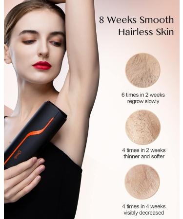 IPL Hair Removal Device - Laser Hair Removal for Face Body & Bikini Zone | Infinite Light Impulses 2 Attachments - V10-1 - Buy Online on GoSupps.com