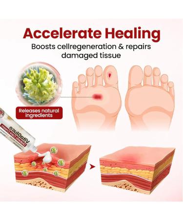  Generisch Foot cream - Gentle moisturizing foot cream - Non-greasy pedicure cream - Skin care for women men seniors and athletes - Buy Online on GoSupps.com