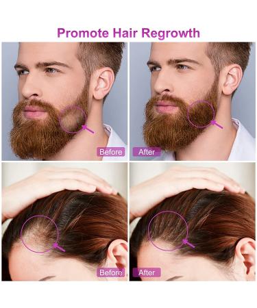 6 in 1 Derma Roller Kit for Face and Body - Micro Needle Dermaroller with Replaceable Heads, Storage Case, and Disinfection Tank - Buy Online on GoSupps.com