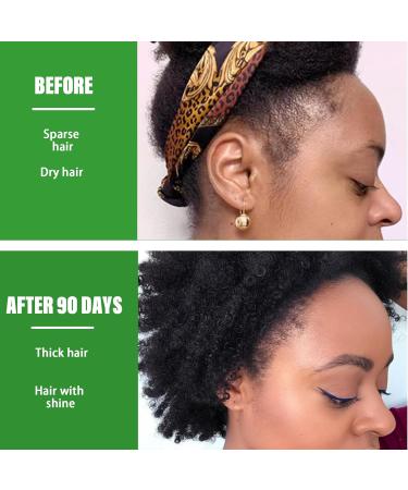 Ziyonix Batana oil for hair crude batana oil for hair growth 100 pure and crude Batana oil for shark from Honduras promotes thicker stronger hair for men and women 118 ml - Buy Online on GoSupps.com