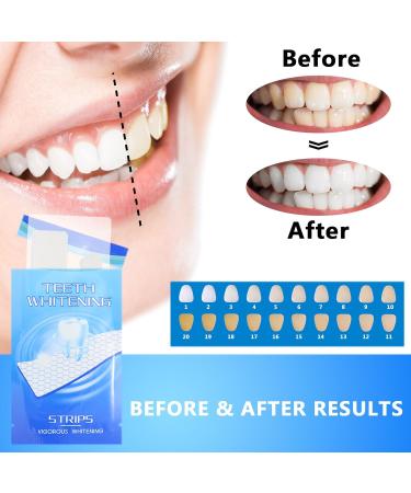 Teeth Whitening Strips | Professional Safe Kit for Whiter Teeth in 30 Minutes | Non-Sensitive 7 Treatments - Buy Online on GoSupps.com