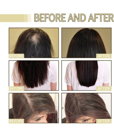 Rosemary Oil For Hair Growth Organic Extra Strength Professional Treatment for Hair Loss Premium Essential Oils Nourishing Split Ends and Dry Scalp for All Hair Types - Buy Online on GoSupps.com
