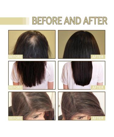 Natural Hair Growth Oil - Repair Thin Dry Damaged Hair | Unscented Black Castor Oil 2 Fl Oz - International Shipping Available - Buy Online on GoSupps.com