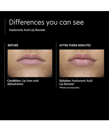 PCA SKIN Hyaluronic Acid Boosting Serum & Lip Booster Bundle - Anti-Aging Facial Treatment & Plumping Lip Balm Helps Repair Long Lasting Moisture to Dry Skin & Chapped Lips - Buy Online on GoSupps.com