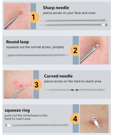 Black Head Remover Tools Blackhead Pore Vacuum: Electric Facial Pore Cleaner 3 Suction Levels Rechargeable Pimple Comedone Extractor Skin Care for Face - Buy Online on GoSupps.com
