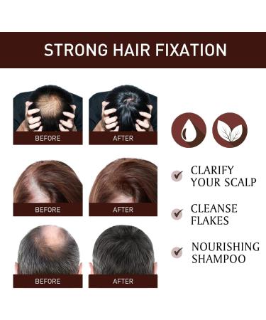 Rosemary Oil for Hair Hair Growth Oil Ginseng Hair Regrowth Serum Relieve Dry Damaged Hair to Target Hair Loss Hair Growth Oil for Hair Rapid Growth and Thickening Trengthen Hair Roots - Buy Online on GoSupps.com