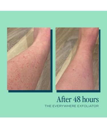 Everywhere Exfoliator 180ml | Natural Vegan Body Scrub with Glycolic & Lactic Acid | Hydrating AHA Formula with Vitamin E | Gentle Daily Use | pH Balancing | Travel Size - Buy Online on GoSupps.com