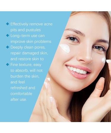 Acne Repair Face Cream - Moisturiser Face Women - Face Moisturizer for Women - Deeply Nourishes Skin - Skin Lightening Cream - Light Texture and Easy Absorption - Buy Online on GoSupps.com