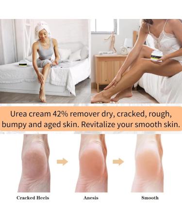 Tongyend Urea Foot Cream Urea 42% Foot Cream Cracked Heel Repair Cream For Dry Hard Skin Callus Remover Foot Moisturiser Nourishes Softens Dry Rough Cracked Dead Skin Foot Care - Buy Online on GoSupps.com