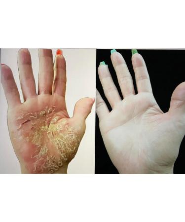 X-ZYME Itch Cream | Anti-Aging Skin Care | Relieve Itch & Reverse Skin Damage - Buy Online on GoSupps.com