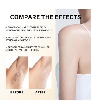 Cyperus Rotundus Oil - 30mL (1.05 FL.OZ) Natural Plant-Based Hair Removal Care Oil Gentle for Sensitive Skin Deeply Moisturizes Reduces Irritation & Soothes Dry Skin (2PCS) 0.53 Fl Oz (Pack of 2) - Buy Online on GoSupps.com