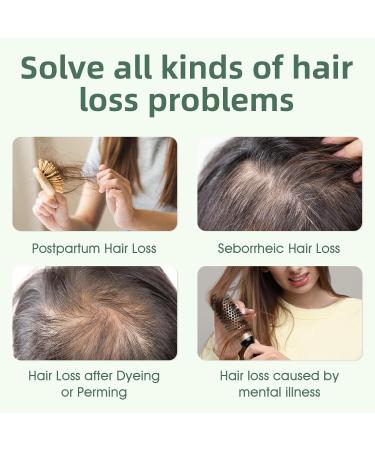 Rosemary Biotin Shampoo for Thinning Hair - Vegan Hair Growth & Volumizing Formula with Biotin & Jojoba Oil - Sulfate Silicone & Paraben Free - 11.8 oz - Buy Online on GoSupps.com