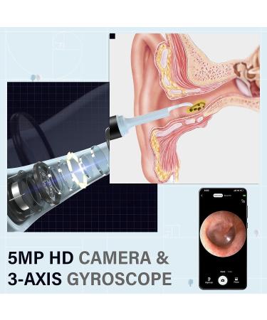 eXempt Visual Ear Wax Removal Otoscope with Camera - Earwax Remover Endoscope for iPhone, iPad & Android - Black - Buy Online on GoSupps.com