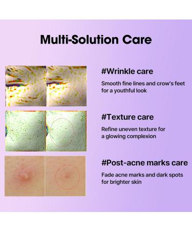 SOME BY MI Retinol Intense Reactivating Serum 50ml S rum cor en au bakuchiol & r tinol Raffermit la peau r duit les pores et les signes de l' ge Soin cor en 50 ml (Lot de 1) - Buy Online on GoSupps.com