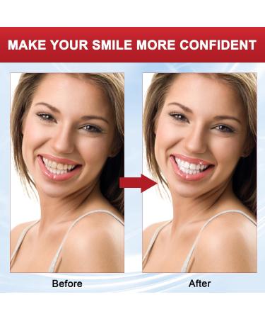SP 8 Probiotic Toothpaste Set - Brightening & Whitening Fresh Breath Deep Cleaning (2 PCS) - International Shipping Available - Buy Online on GoSupps.com