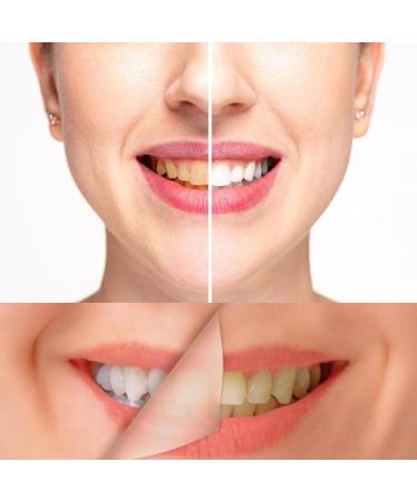Blanc Natural Teeth Whitening Powder - Whiten Teeth with Calcium Carbonate & Activated Carbon | International Shipping Available - Buy Online on GoSupps.com