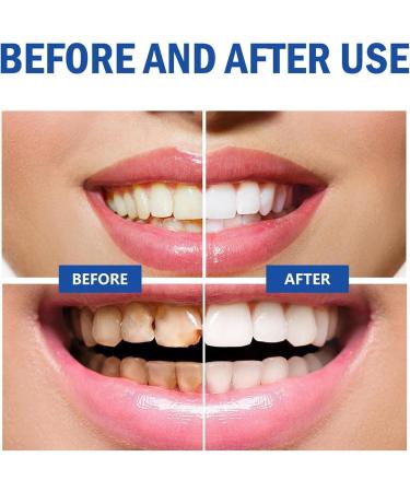 SSENTY Cophksu Sp10 Probiotic Toothpaste Sp10 Whitening Toothpaste Sp10 Toothpaste Fresh Breath Deep Cleaning Care Toothpaste - Buy Online on GoSupps.com