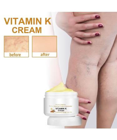 Varicose Veins Miracle Cream - Circulheal Vitamin K Cream (3 PCS) | Best Treatment for Varicose Veins - Buy Online on GoSupps.com