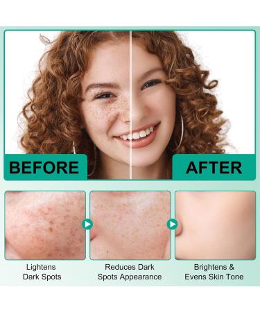 2PCS Correcting Serum for Face - Dark Spot Remover with Niacinamide & Vitamin C for Melasma Sun Spots & Freckles - Uneven Skin Tone Treatment - 2 fl oz - Buy Online on GoSupps.com