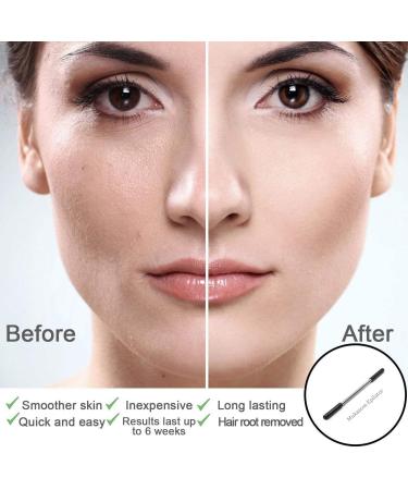 Mukazom Facial Hair Removal Spring Epilator for Women - Remove Hair on Cheeks, Neck, Upper Lip, and Chin - Black - Buy Online on GoSupps.com