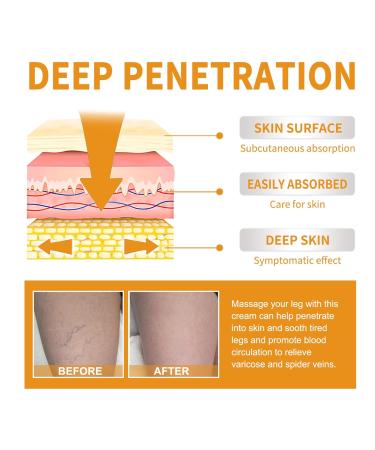 Vitamin K Cream for Varicose Veins - Miracle Cream for Spider Veins & Leg Vein Removal (1pcs) - Fast International Shipping - Buy Online on GoSupps.com