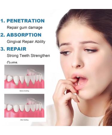 Shark Cartilage Protein Dental Regrowth Drops Shark Cartilage Protein Dental Care Drops Gum Regrowth for Receding Gums Gum Regrowth Treatment Gum Relief Drops Strengthen Gum Attachment (3PCS) - Buy Online on GoSupps.com