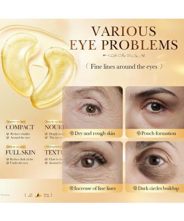 Virecose Lip Balm 2 Soothing Lip Treatment with Vitamin E 5 g - Buy Online on GoSupps.com