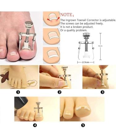 Artcut 9PCS Yellow Toe Nail Clippers Set - Professional Heavy Duty Clippers for Ingrown & Thick Nails - Strong Ingrown Toenail Tool - Buy Online on GoSupps.com