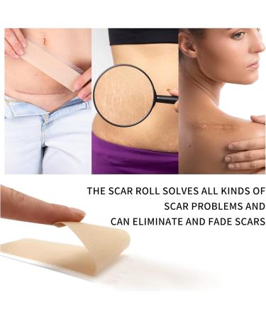 Silicone Scar Removal Foils - Effective Flattening for Surgery Burns Acne & More | 4cm x 300cm - Buy Online on GoSupps.com