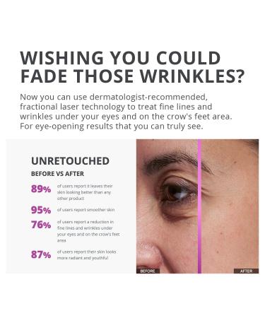 Tria Age-Defying Eye Wrinkle Laser Kit & Spa Sleep Mask - FDA Cleared Treatment for Under Eye Bags Wrinkles Dark Circles - Results in 2 Weeks - Buy Online on GoSupps.com