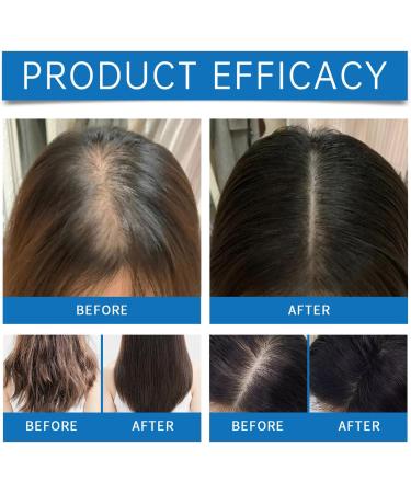 S rum Cheveux Croissance Hair Growth Serum Roll-on Advanced Hair Growth Serum Acc l re La Pousse Des Cheveuxs R duit La Chute Des Cheveuxs Pour Tous Types De Cheveux 25ml - Buy Online on GoSupps.com