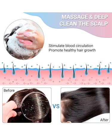Hair Scalp Massager Shampoo Brush Soft Silicone Hair Scrubber Head Massager Brush for Exfoliates Scalp Removes Dandruff Prevents Hair loss Promotes Hair Growth 2 Pack (Blue & Pink) 2-pack Blue & Pink - Buy Online on GoSupps.com