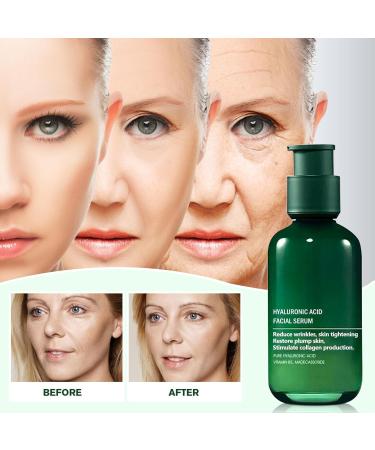 Skin Firming Rejuvenating Serum with Hyaluronic Acid - Anti-Aging Facial Serum for All Skin Types | 2.7 oz - Buy Online on GoSupps.com