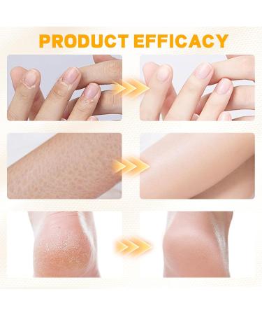 2 Pi ces Cr me l'Ur e 60% et Cr me au miel Cr me pour les pieds secs et craquel s pour Pieds Genoux Mains Coudes Crevass s R paratrice & Hydratante Hydrate limine les Callosit s et Adoucit - Buy Online on GoSupps.com