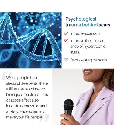 Soothing Scar Removal Cream for Body, Stretch Marks & Tan - Light Blue (One Size) - Buy Online on GoSupps.com