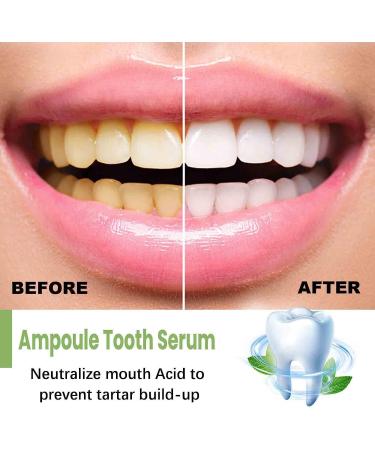 Anti-Dark Tlopa Ampoule Toothpaste & Essence - 3V Fruit Acid Tooth Whitening Serum | 20 Disposable Tartar Removal Treatments - Buy Online on GoSupps.com