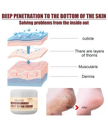Hydrating Foot Care Cream | Repair Dry Cracked Heels | Healing Ointment for Stress Relief - Men & Women - Buy Online on GoSupps.com