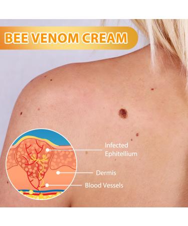 Bee Venom Cream for Repair & Removal | Professional Anti-Aging Cream for Neck Waist Back Hands & Feet - Unisex - Buy Online on GoSupps.com