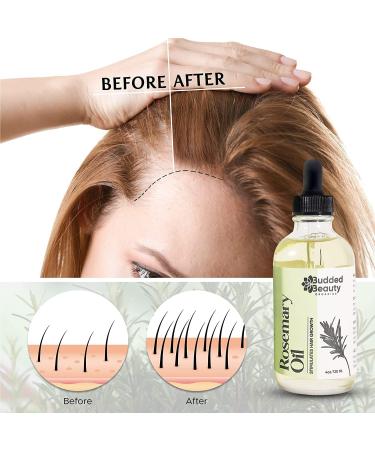 Natural Rosemary Essential Oil for Hair Growth | Effective Hair Treatment for Women & Men with Dropper Bottle - Buy Online on GoSupps.com