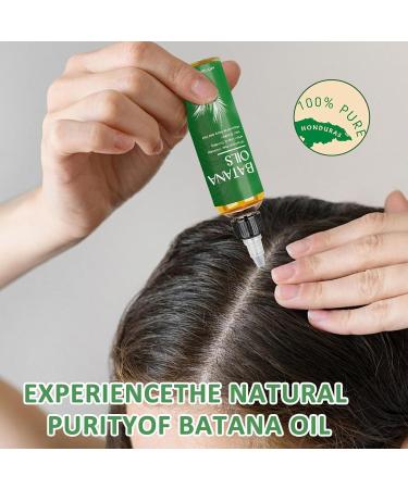Batana Oil for Hair Growth Botana Oil Botana Hair Growth Oil Raw Batana Oil Organic Batana Oil Botana Oil Organic Promote Hair Growth Repair Damaged Hair Suitable for Men and Women (100ml) - Buy Online on GoSupps.com