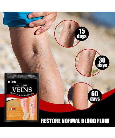 OTBK Varicose Vein Treatment Patch (36pcs) | Leg Spider Vein Removal | Improve Blood Circulation & Relieve Fatigue | One Size - Buy Online on GoSupps.com