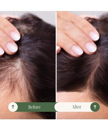 Hair Growth Oil with Batana Oil Castor Oil Rosemary Oil & Coconut Oil. Effective Thickening Conditioner Mask & Hair Loss Scalp Treatment Serum | For Men & Women - Buy Online on GoSupps.com