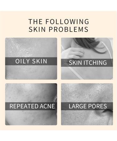 Kojic Acid Soap 3 In 1 Vitamin C & Kojic Acid & Collagen Face & Body Soap Bar Natural Brightening & Acne Control Kojic Soap Turmeric Kojic Acid Soap Moisturizing & Redness & Acne - Buy Online on GoSupps.com