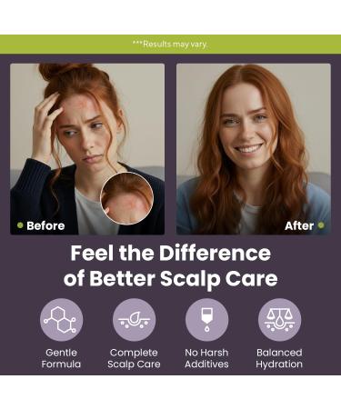 Marie Originals Eczema & Psoriasis Nourishing Shampoo and Conditioner Bundle Itchy Scalp Relief Dry Scalp Shampoo & Hydrating Conditioner with Tea Tree Lavender & Peppermint 8 oz Each - Buy Online on GoSupps.com