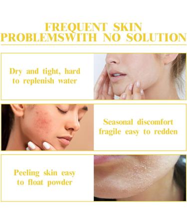 Azelaic Acid Cream Face Skin Care Beauty with Niacinamide & Vitamin C Azelaic Acid Suspension 10% Face Serum Reduce Blemishes Remove Acne&Rosacea Shrink Pore Face Cream for All Skin Types 30ML (1) - Buy Online on GoSupps.com
