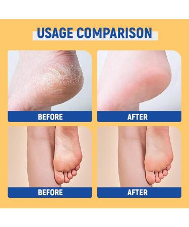  G n rique Moisturizing Foot Cream Heel Balm Foot Repair Cream Moisturizing Foot Cream Restores Skin Softening Exfoliating Cream Moisturizing and Anti-Cracking - Buy Online on GoSupps.com