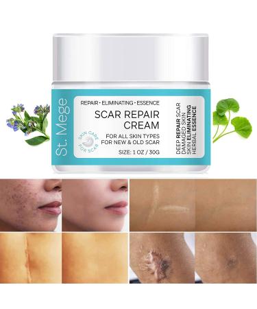 Scar Removal Cream, Scar Cream For Old Scars - Stretch Mark Removal Cream for Men & Women - Stretch Marks Relief and Burns Repair, Face Skin Repair Cream 1 Ounce (Pack of 1)